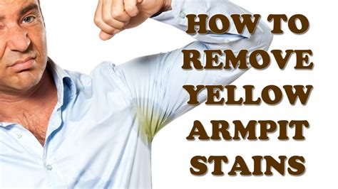 Can yellow underarm stains be removed?