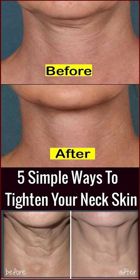 Can yoga tighten neck skin?