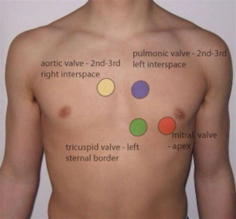 Can you Auscultate a pulse?