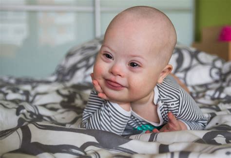 Can you avoid having a Down syndrome baby?