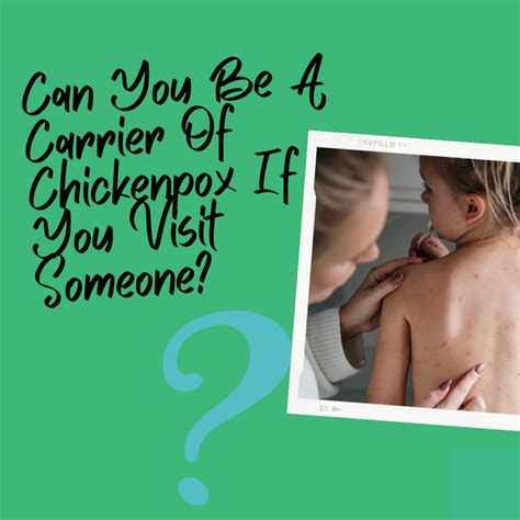 Can you be a carrier of chickenpox if you visit someone?