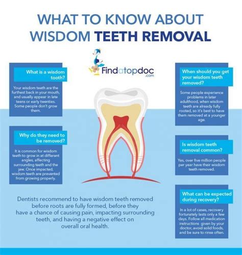 Can you be alone after wisdom teeth removal?