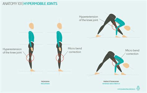 Can you be hypermobile but inflexible?