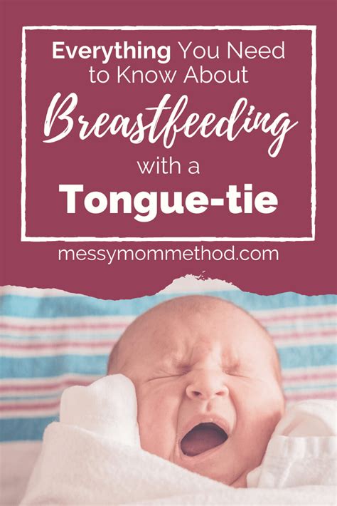 Can you breastfeed with tongue-tie?