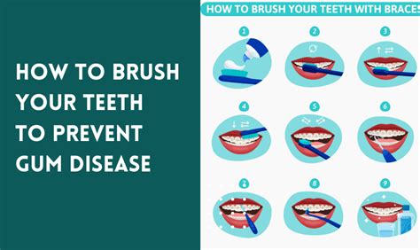 Can you brush away a gum infection?