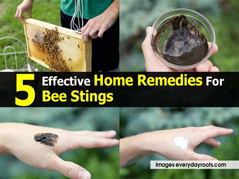 Can you build immunity to bee stings?