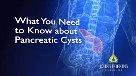 Can you completely heal from pancreatitis?