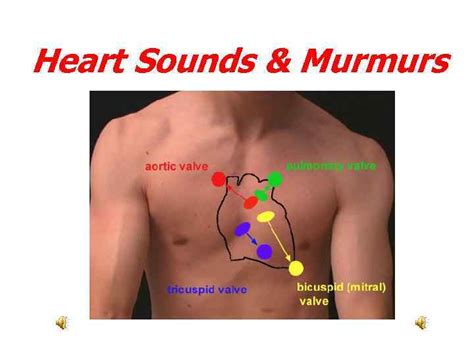 Can you detect a heart murmur with a stethoscope?
