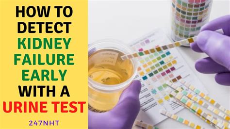 Can you detect kidney failure in urine?