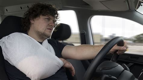 Can you drive with a cast in California?