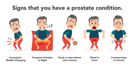 Can you feel a bad prostate?