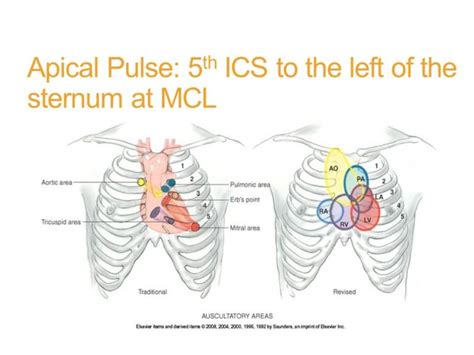 Can you feel apical pulse?