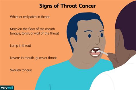 Can you feel early throat cancer?