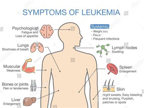 Can you feel fine with leukemia?