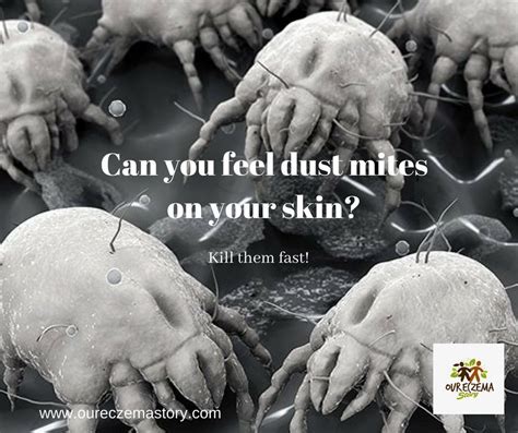 Can you feel mites on your skin?
