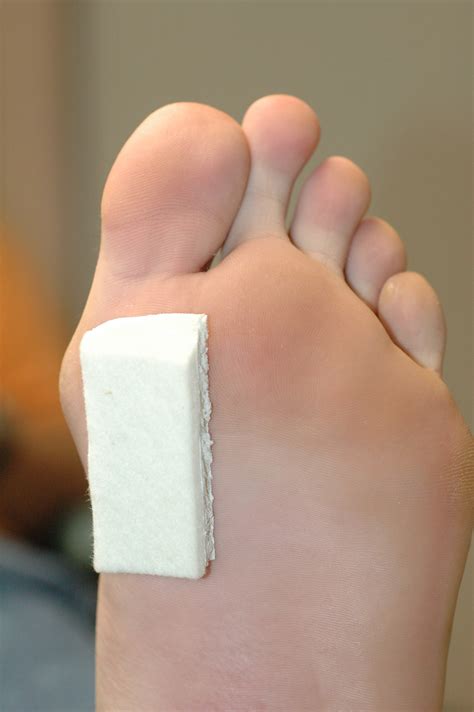 Can you fix Morton's toe?
