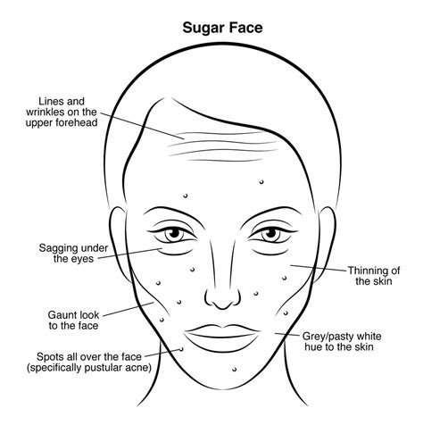 Can you fix sugar face?