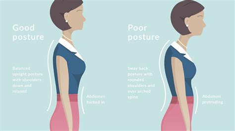 Can you force good posture?