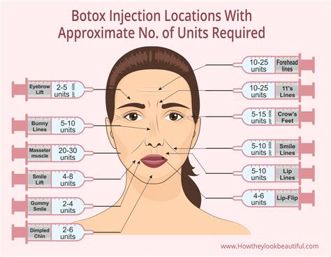 Can you get Botox while on antidepressants?