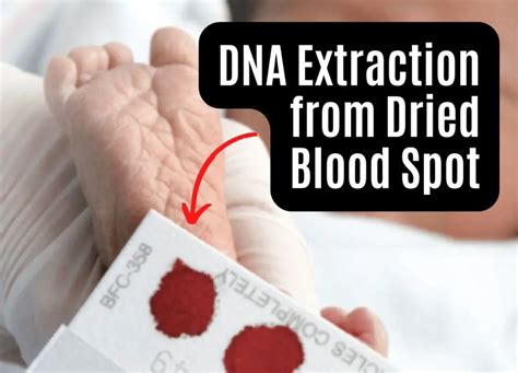 Can you get DNA from dried blood?