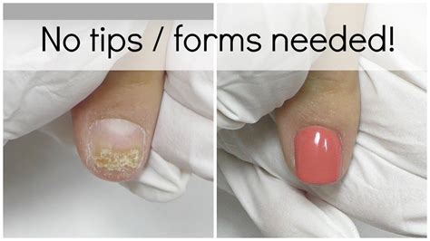 Can you go into surgery with acrylic nails?