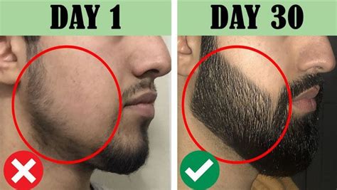 Can you grow a beard in 2 months?