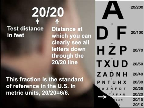 Can you have 200 vision?