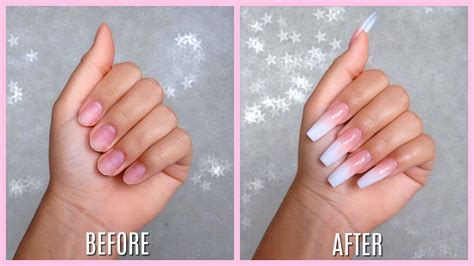 Can you have acrylic nails before surgery?