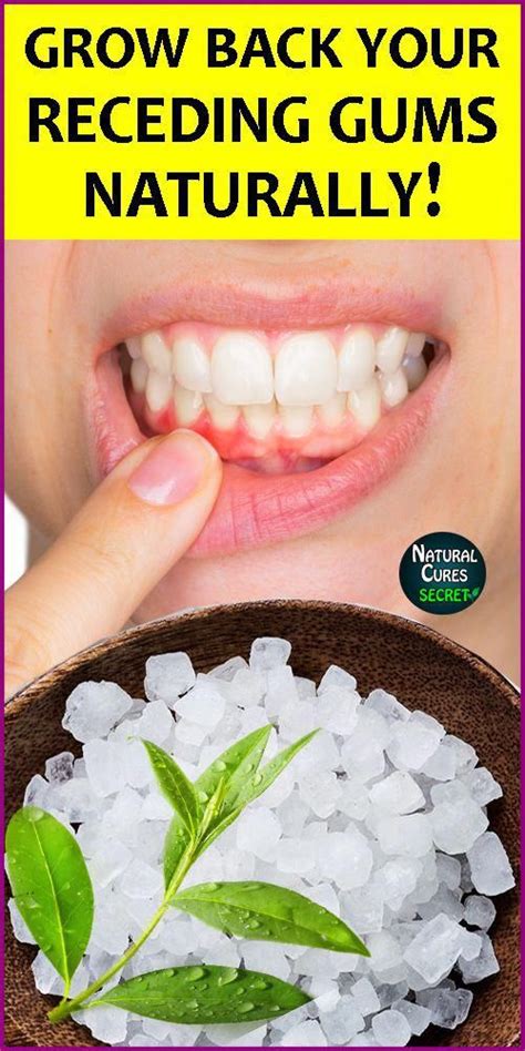 Can you heal a gum infection naturally?