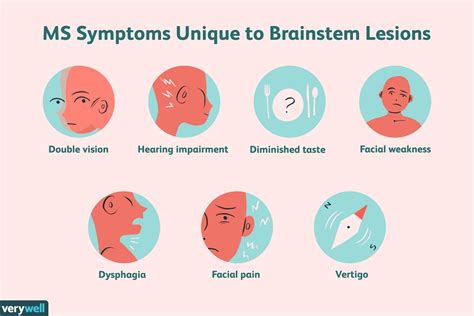 Can you heal brain lesions from MS?