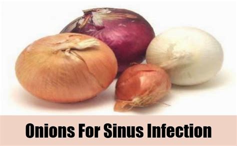 Can you inhale onion for sinus infection?