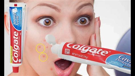 Can you leave toothpaste on skin?