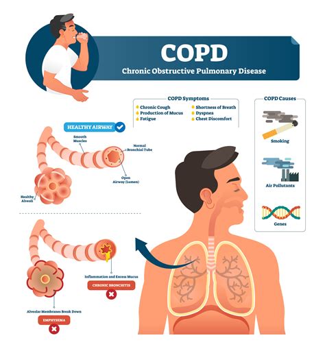 Can you live 20 years with moderate COPD?