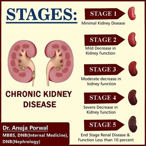 Can you live 20 years with stage 3 kidney disease?
