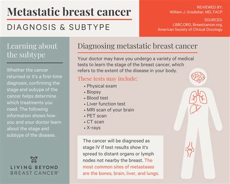 Can you live 30 years with metastatic breast cancer?