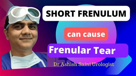 Can you live with a short frenulum?