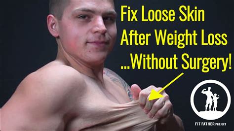 Can you lose 30 kg without loose skin?