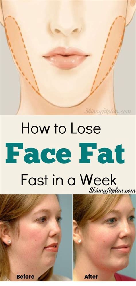 Can you lose fat from your face?