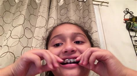 Can you make your own braces?