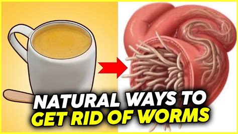 Can you naturally get rid of a tapeworm?