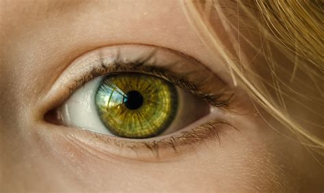 Can you naturally have yellow eyes?