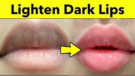 Can you naturally lighten dark lips?