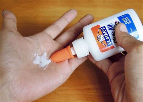 Can you peel off medical glue?