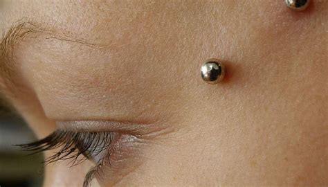 Can you prevent piercing rejection?