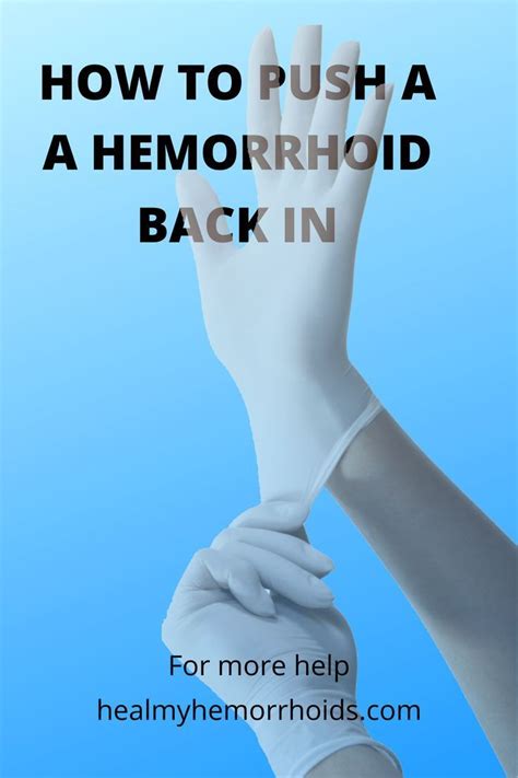 Can you push a hemorrhoid back in with your finger?