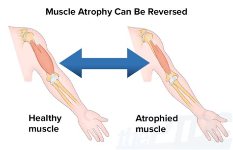 Can you regrow atrophied muscle?