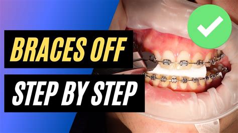 Can you remove braces at home?