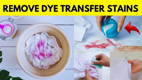 Can you remove dye transfer from clothes?
