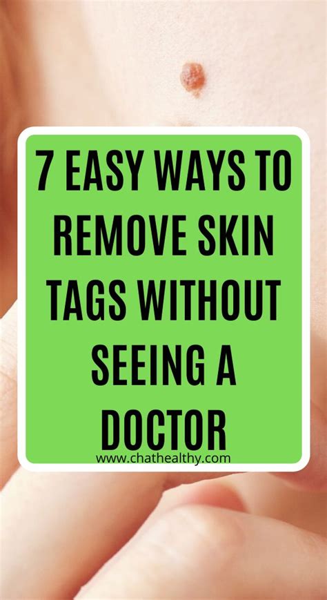 Can you remove small skin tags yourself?