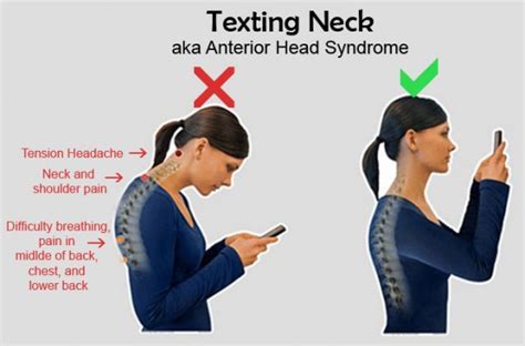 Can you reverse phone neck?